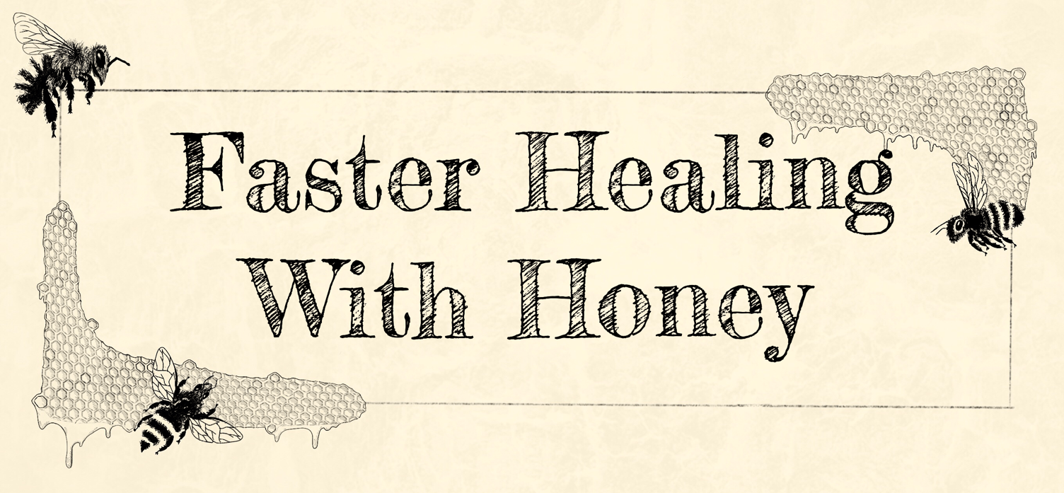 Honey, Burn Remedy, Natural Remedies